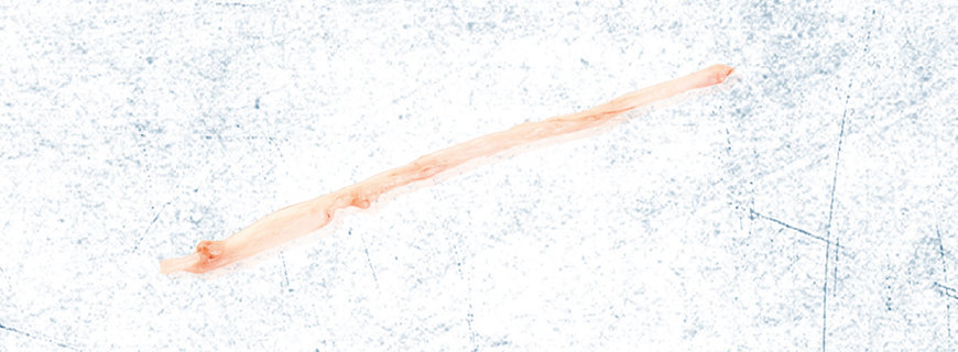 Blase cuts-11-header