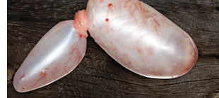 Schwimmblase